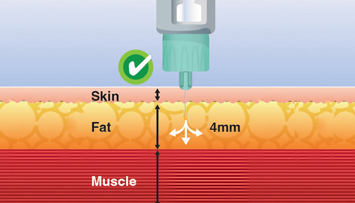 Needle length 